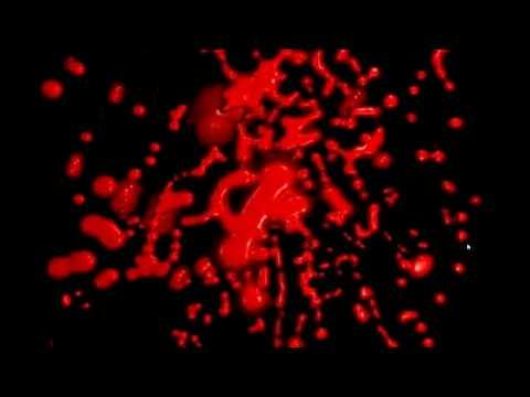 Hypertension HD sur Dreamcast refait parler de lui Image de prévisualisation YouTube