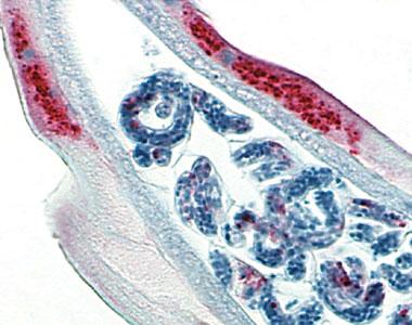 wolbachia en rouge dans ce nematode