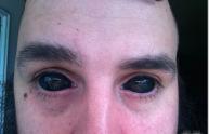 Eye ball tattoo ou yeux de billes : le tatouage des yeux ...