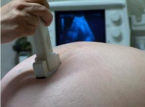 ASTHME: L'obésité maternelle multiplie par 4 le risque de l'enfant – Paediatric and Perinatal Epidemiology