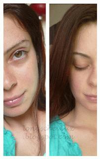 Une routine visage 100% naturelle contre l'acné ?