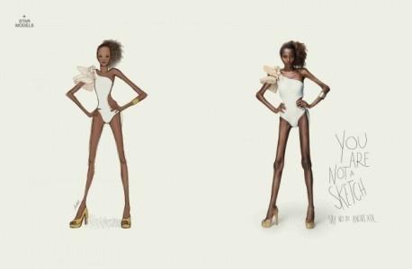 Anorexie : la campagne qui dénonce