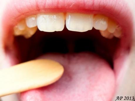 A Tirez la langue et dites ahh! / Stick out your tongue and say ahh!