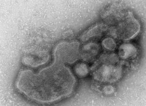 Virus H7N9: La très faible immunité des populations asiatiques – The Journal of Infectious Diseases