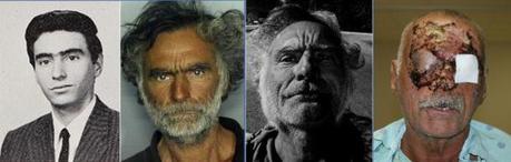 RONALD POPPO UN AN PLUS TARD : LA VICTIME DU CANNIBALE DE MIAMI SE REMET DE SES OPERATIONS CHIRURGICALES Ronald Poppo - CAS DE CANNIBALISME : UN HOMME DEVORE LE VISAGE D'UN AUTRE HOMME ET SA VICTIME MONTE UNE FONDATION POUR PAYER SES OPERATIONS DE CHIRURGIE (Ronald Poppo foundation)