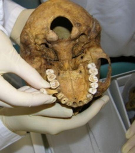 L'aridité de la vallée antique finira-t-elle aujourd'hui par la disparition finale du Nil ?... en Égypte ancienne ! http://img.maxisciences.com/momie/l-analyse-des-dents-de-momies-a-permis-de-conna-tre-mieux-le-regime-alimentaire-a-l-epoque-de-l-egypte-antique_61162_w460.jpg