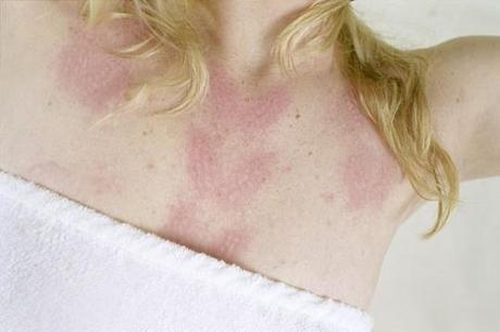 La peau d’Ariana Russel 8_709