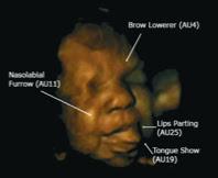 Les expressions faciales chez les foetus