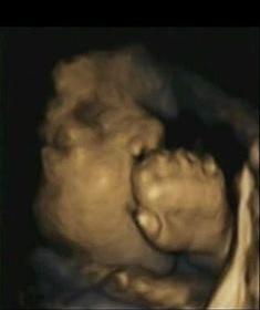 DÉVELOPPEMENT: Le foetus s'initie au toucher dans l'utérus de la mère – Developmental Psychobiology