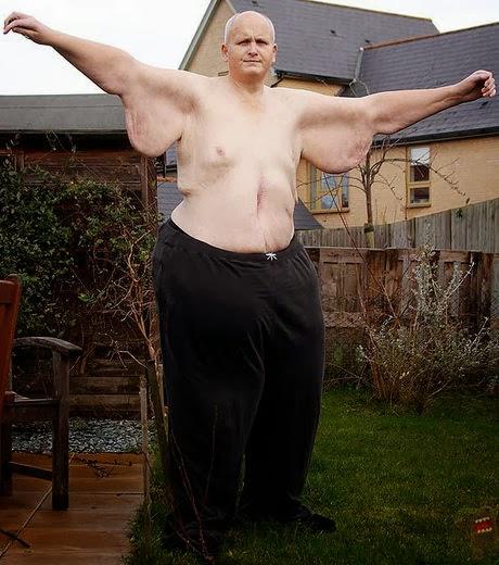 Paul Mason, l’homme le plus gros du monde a perdu son titre