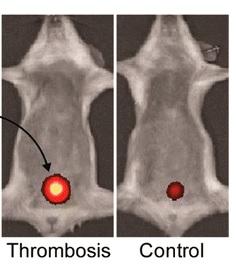 THROMBOSE: Vers un test d'urine pour détecter les caillots – ACS Nano