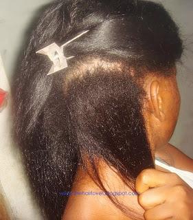 Les vitamines de la chute des cheveux