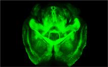 cerveau-transparent #1 La biologie c’est fantastique : le blobfish, c’est pas si horrible