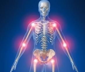 ARTHROSE: Vers une suspension européenne de la diacéréine – EMA ARTHROSE: Vers une suspension européenne de la diacéréine – EMA