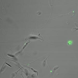 INFERTILITÉ: Des nanoparticules pour rechercher les anomalies du sperme – Nanomedicine: Nanotechnology, Biology, and Medicine INFERTILITÉ: Des nanoparticules pour rechercher les anomalies du sperme – Nanomedicine: Nanotechnology, Biology, and Medicine