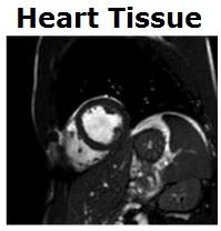 Les BOISSONS ÉNERGISANTES altèrent la fonction cardiaque – RSNA 2013 Les BOISSONS ÉNERGISANTES altèrent la fonction cardiaque – RSNA 2013