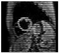 Les BOISSONS ÉNERGISANTES altèrent la fonction cardiaque – RSNA 2013 Les BOISSONS ÉNERGISANTES altèrent la fonction cardiaque – RSNA 2013