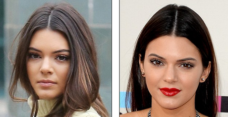 Kendall Jenner : Est-ce qu'elle a reçu une rhinoplastie ?