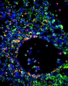 GRIPPE: Découverte d'une enzyme de résistance à l'infection – Cell Host & Microbe