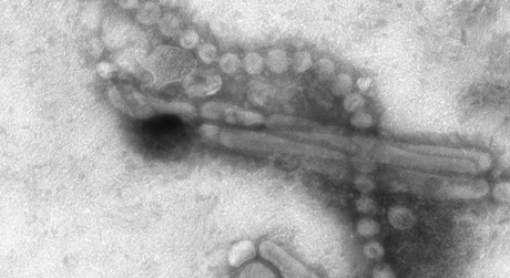 Grippe A H7N9