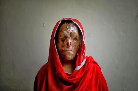 DOMESTIC VIOLENCE | Emilio Morenatti DOMESTIC VIOLENCE | Emilio Morenatti