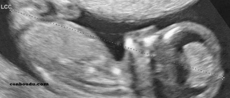 Parole aux papas : La 1ère échographie #8 Parole aux papas : La 1ère échographie #8