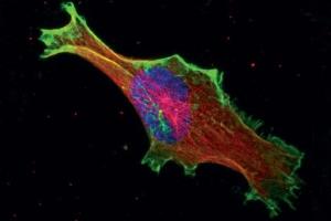 CANCER: Les cellules cancéreuses savent bien où elles vont – PNAS