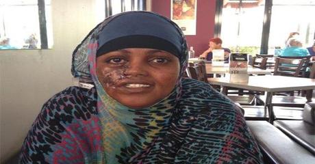 Quand l’imprimante 3D redonne le sourire… Quand l’imprimante 3D redonne le sourire…