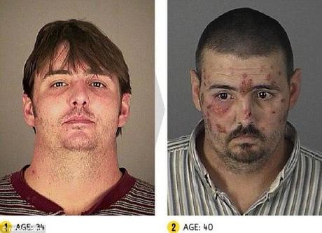 SANTE. Photos + vidéo: les effets dévastateurs des drogues dures sur notre corps drog4