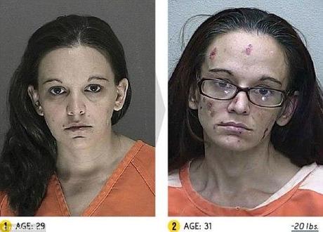 SANTE. Photos + vidéo: les effets dévastateurs des drogues dures sur notre corps drog3