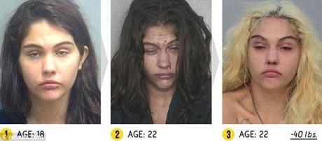 SANTE. Photos + vidéo: les effets dévastateurs des drogues dures sur notre corps drog5