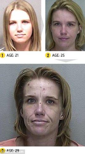 SANTE. Photos + vidéo: les effets dévastateurs des drogues dures sur notre corps drog7