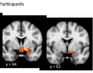 CANNABIS: Il altère la structure du centre de récompense du cerveau – The Journal of Neuroscience