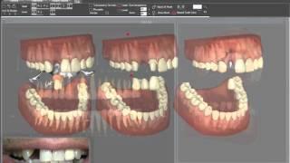 Dental master pro 3D : le patient peut revoir le plan de traitement sur Internet