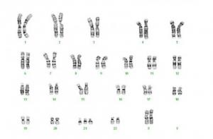 TRISOMIE 21: Petit chromosome, grands effets sur le génome  – Nature