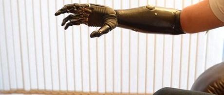 arm-bionic-technology-prothese-mogwaii