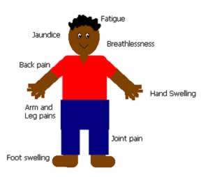 19 juin 2014 ! Journée mondiale de la lutte contre la maladie de la douleur ! Partout la douleur