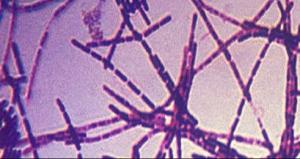 ANTHRAX: 75 scientifiques américains contaminés  – CDC