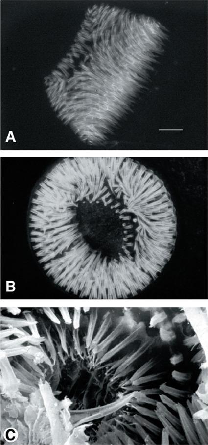 Epines du proventricule de la puce Xenopsylla cheopis, les deux premières photos en fluorescence (les épines sont auto-fluorescentes) et la 3ème au microscope électronique à balayage Epines du proventricule de la puce Xenopsylla cheopis, les deux premières photos en fluorescence (les épines sont auto-fluorescentes) et la 3ème au microscope électronique à balayage