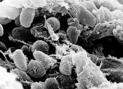 Groupe de Bactéries Yersinia pestis vues au microscope électronique à balayage Groupe de Bactéries Yersinia pestis vues au microscope électronique à balayage