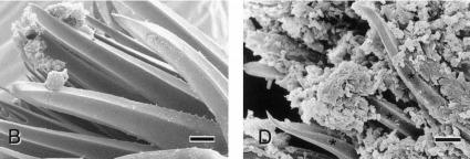 Croissance d’un biofilm de Yersinia pestis sur les épines du proventricule d’une puce vue au microscope électronique à balayage Croissance d’un biofilm de Yersinia pestis sur les épines du proventricule d’une puce vue au microscope électronique à balayage