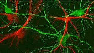 TOXICOMANIE: La dépendance a sa voie de neurotransmission  – Nature Neuroscience