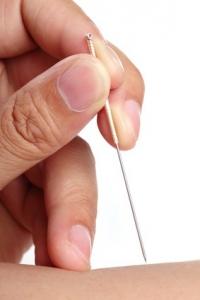 MÉNOPAUSE: Un peu d'acupuncture contre les bouffées de chaleur – Menopause