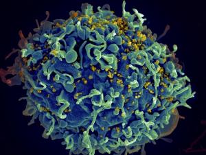 VIH: Le virus constitue ses réservoirs avant de commencer à circuler – Nature