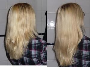 Arrêter la chute des cheveux au stress