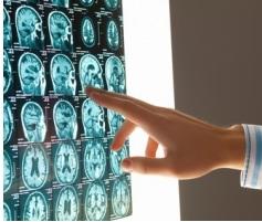 NEURO: Ce coin de cerveau qui reste jeune malgré l'âge – International Cognitive Neuroscience Conference