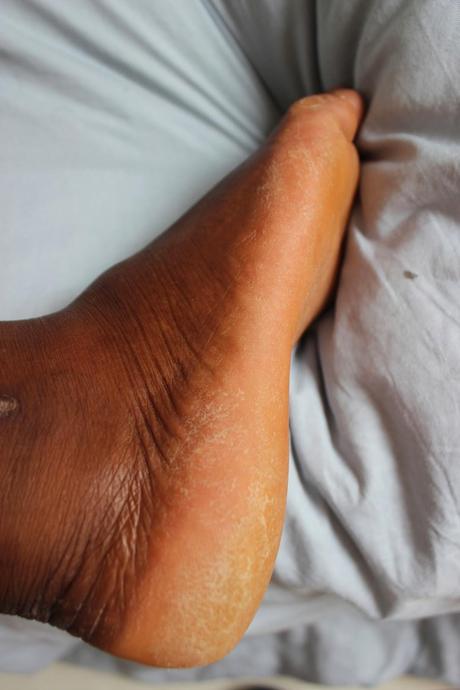 Faire peau neuve avec Baby Foot Faire peau neuve avec Baby Foot