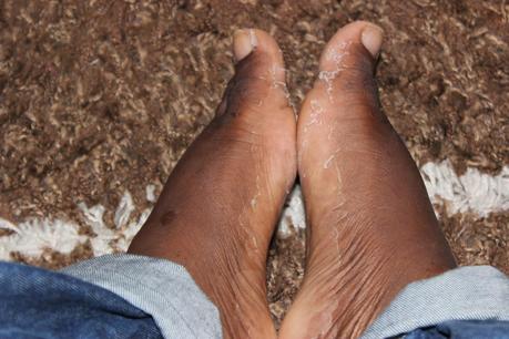 Faire peau neuve avec Baby Foot Faire peau neuve avec Baby Foot