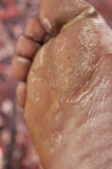 Faire peau neuve avec Baby Foot Faire peau neuve avec Baby Foot