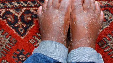 Faire peau neuve avec Baby Foot Faire peau neuve avec Baby Foot